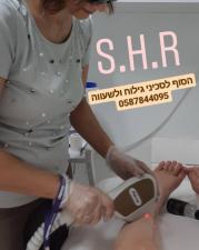 הסרת שיער אפילציה