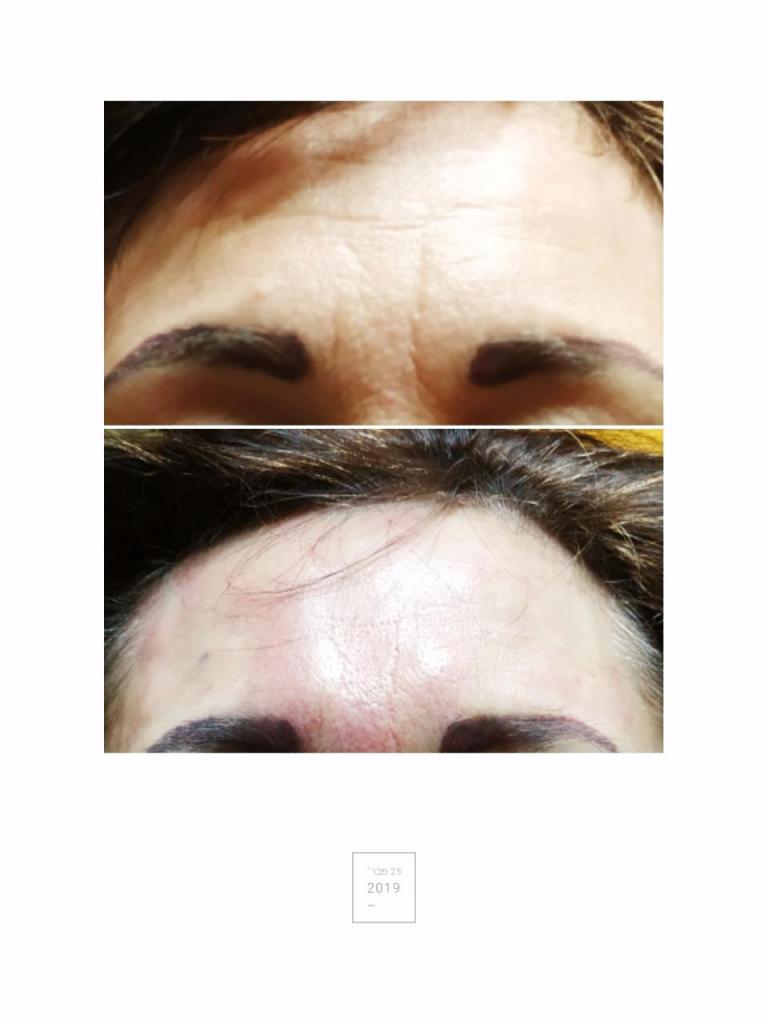 קליניקה לאה קליניקה לאה