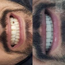 מרפאת שיניים ד"ר קובטי