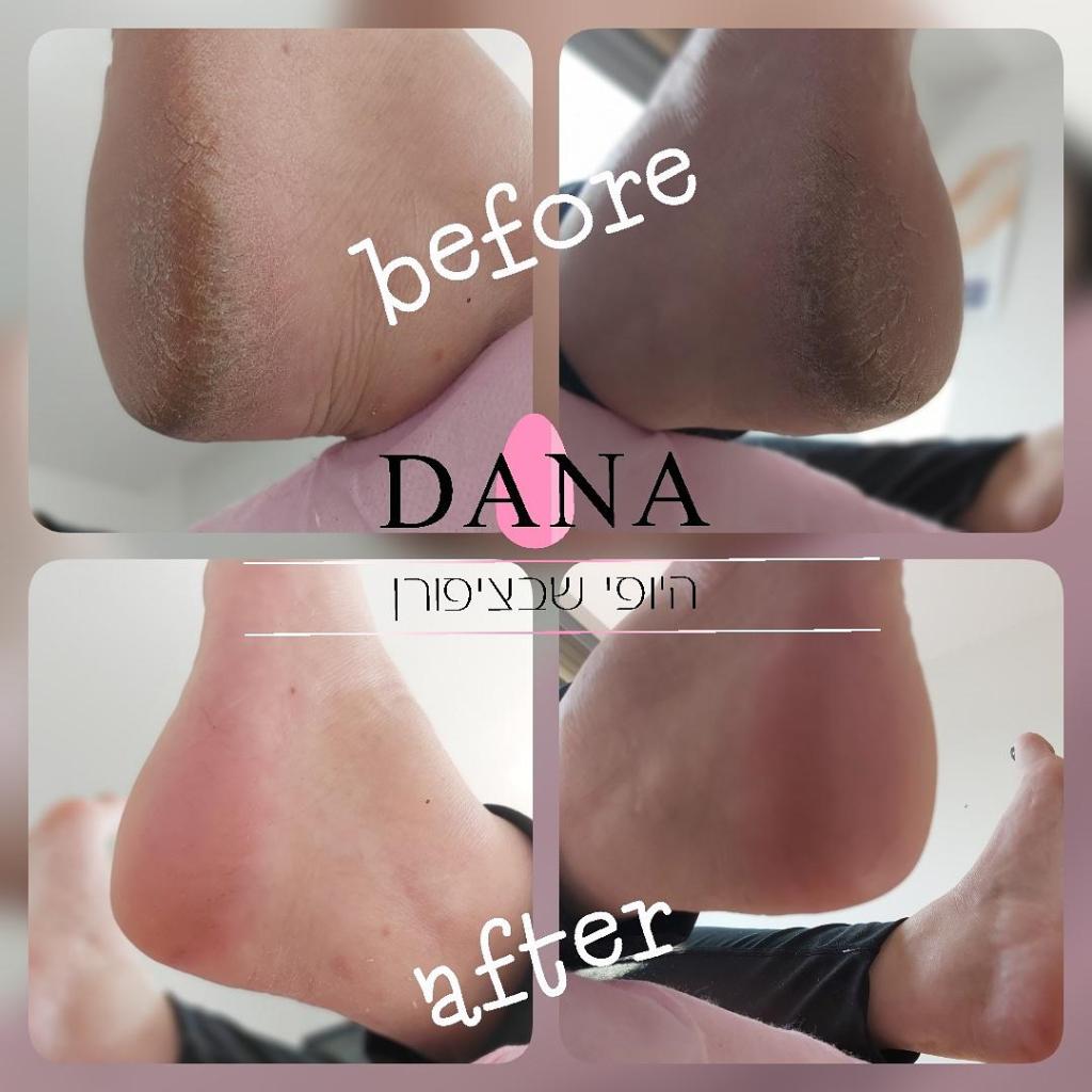 דנה היופי שבציפורן דנה היופי שבציפורן