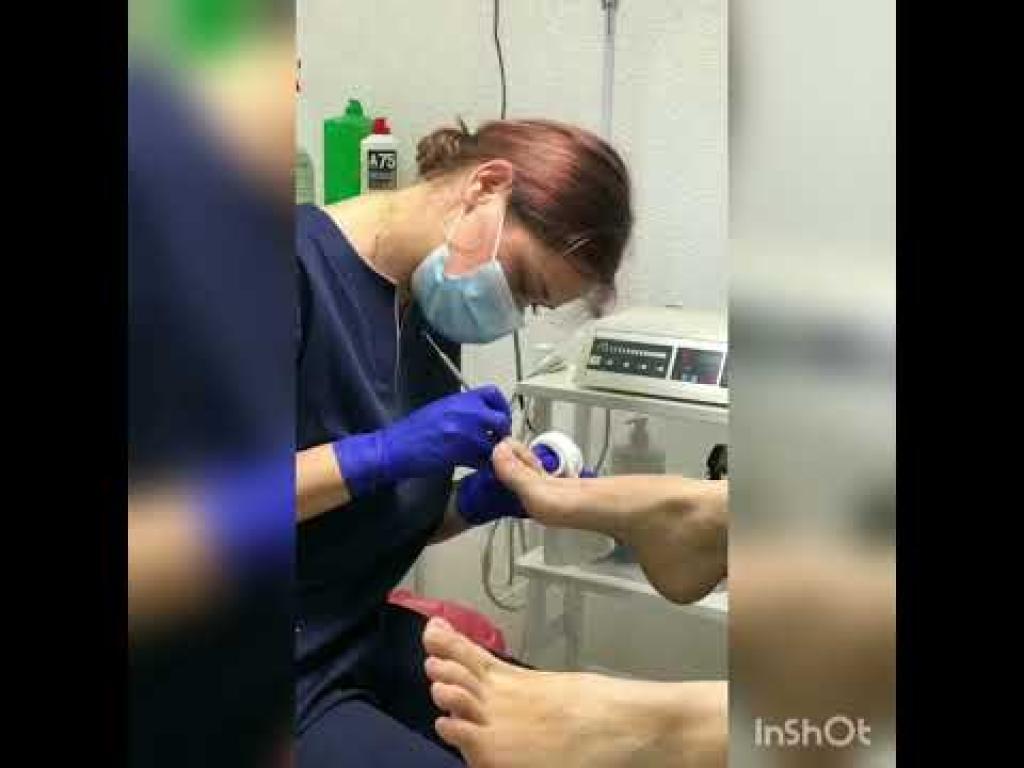 אירינה הפודולוגית אירינה הפודולוגית