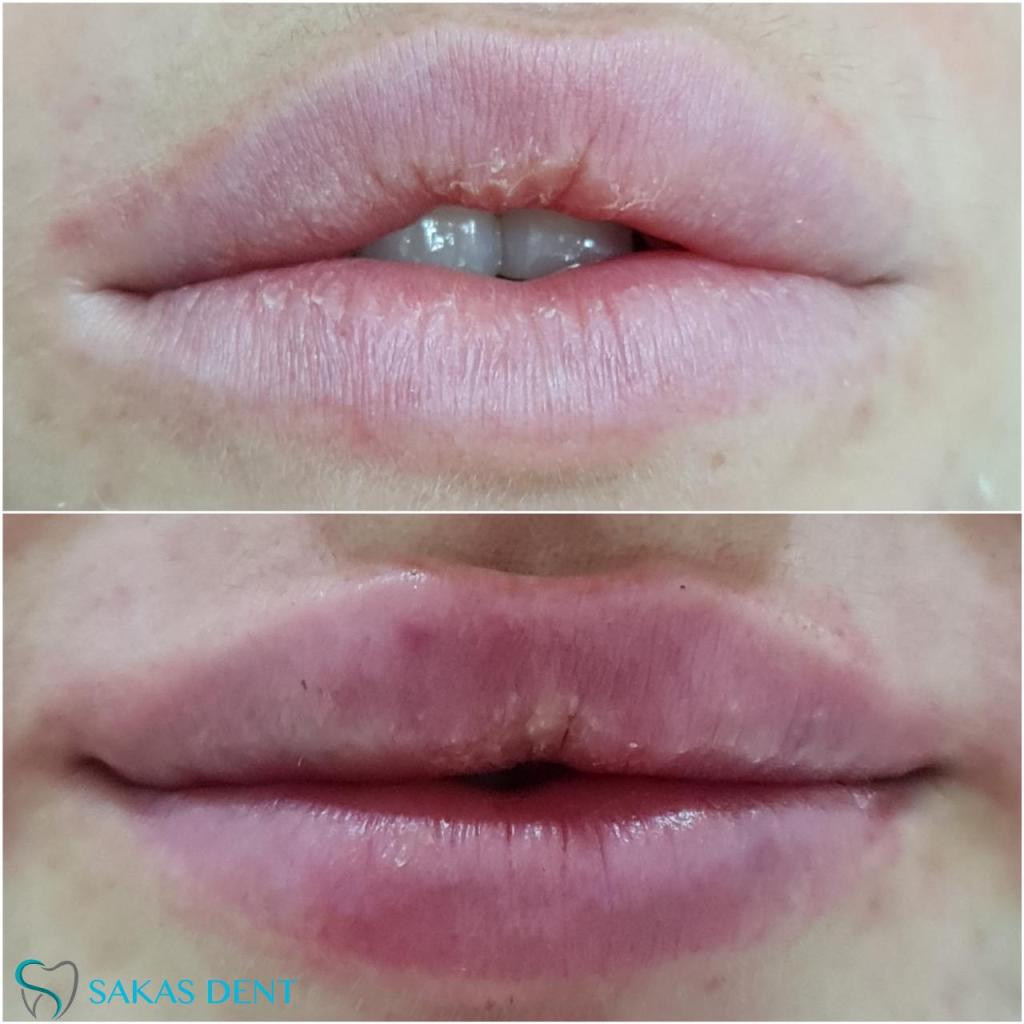 Sakas dent סכס דנט Sakas dent סכס דנט