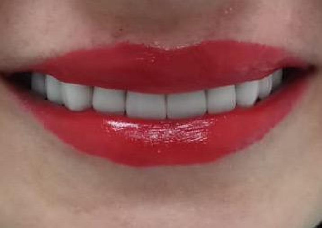 פירוב שמחה דנט פירוב שמחה דנט