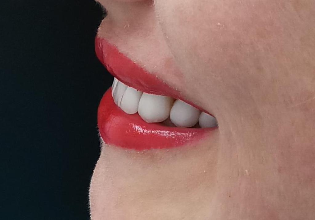 פירוב שמחה דנט פירוב שמחה דנט