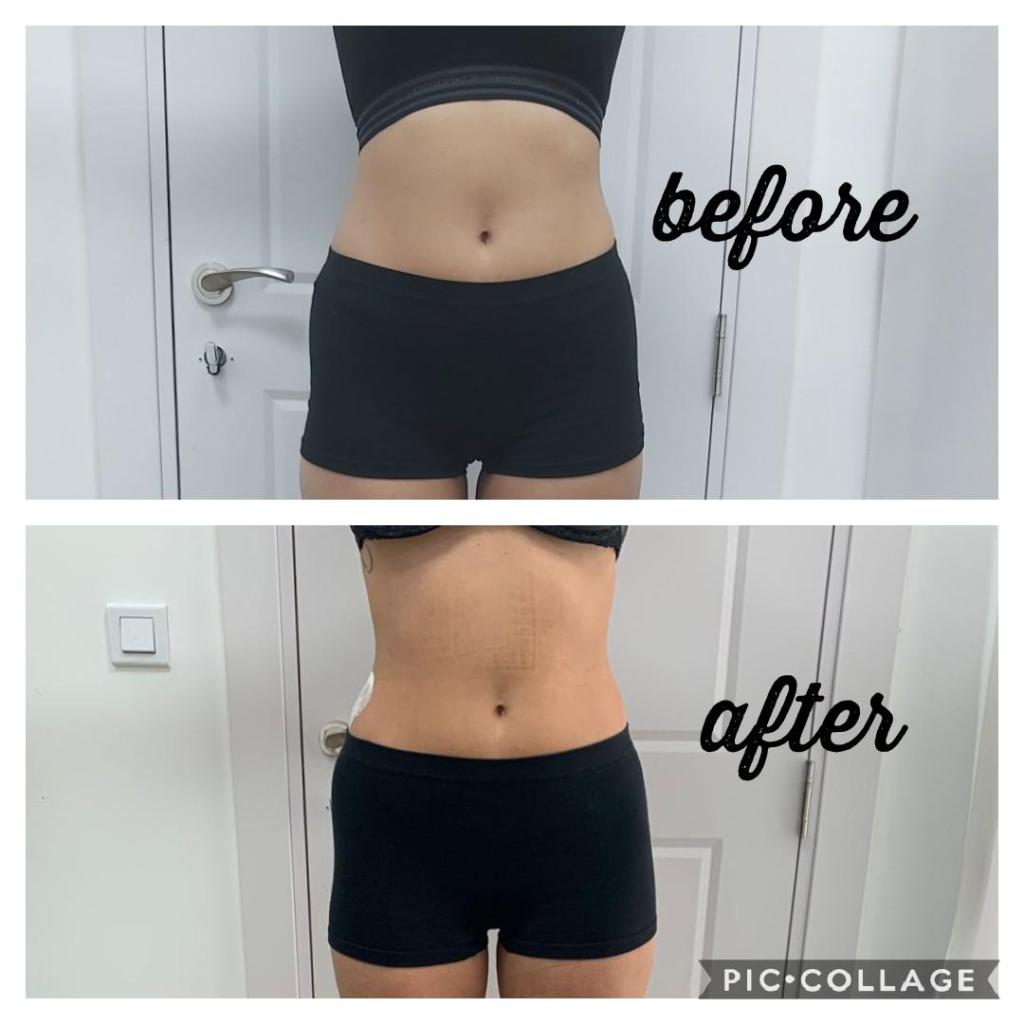 Royal body ICE21 Royal body ICE21