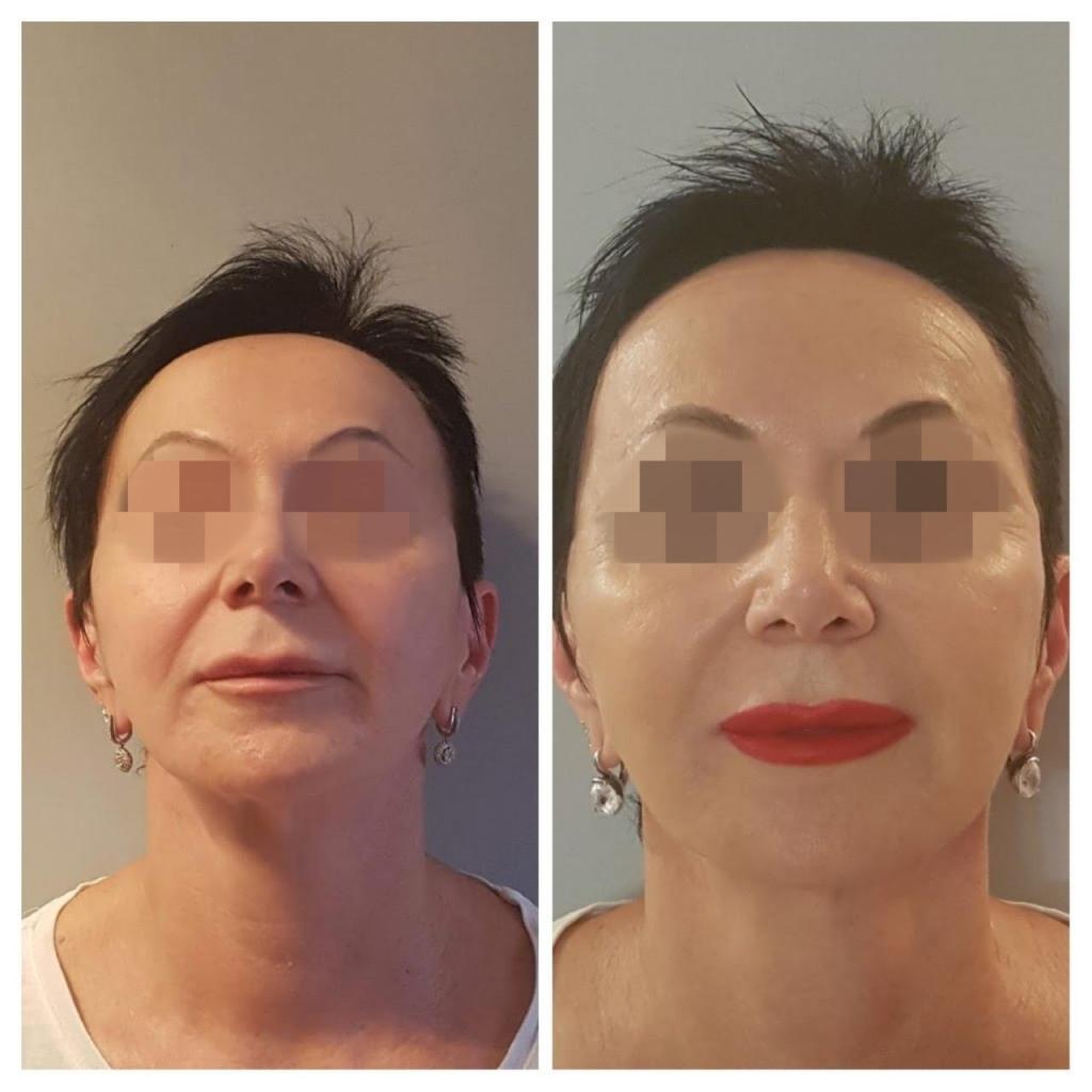 ד"ר רוני אולגיסר MD ד"ר רוני אולגיסר MD