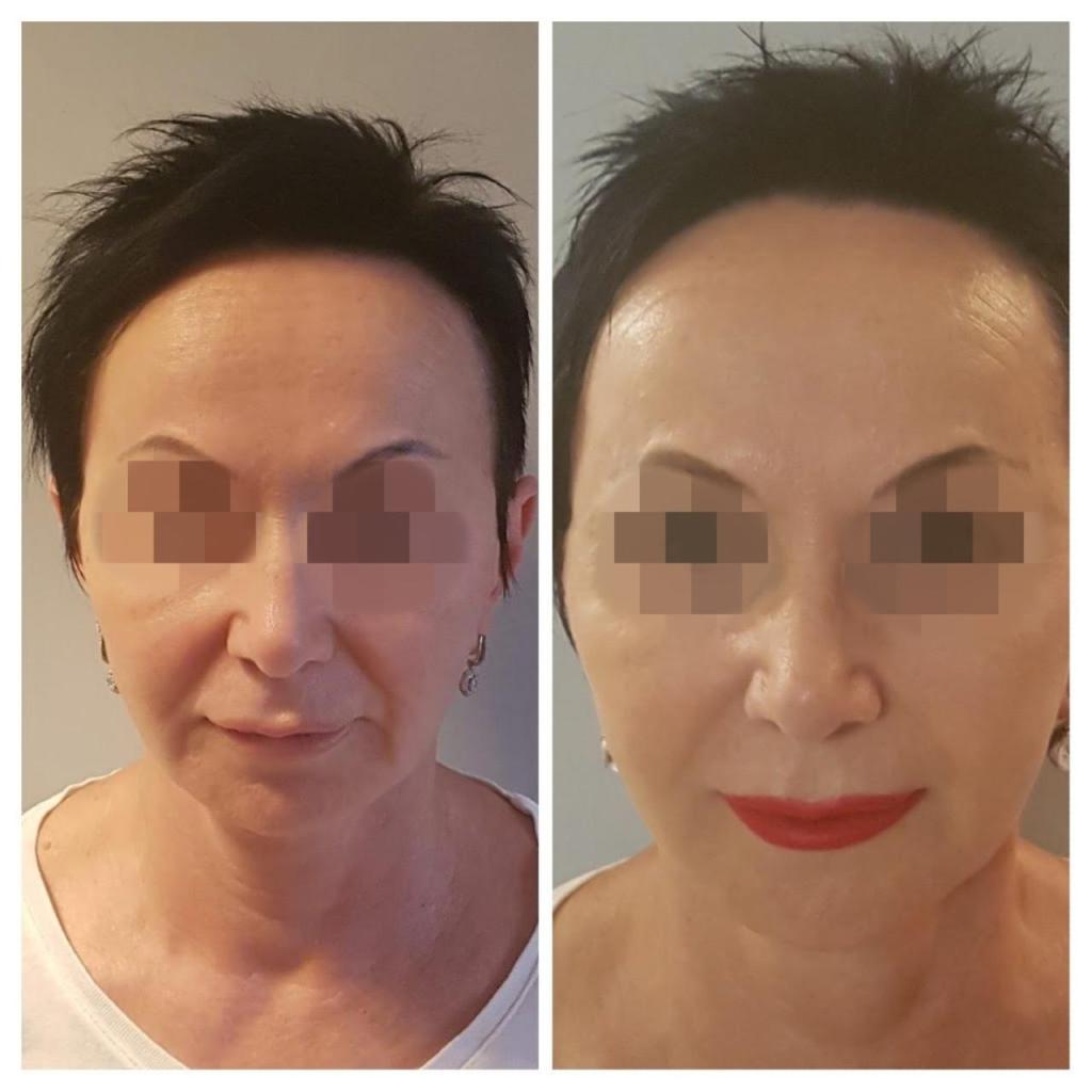 ד"ר רוני אולגיסר MD ד"ר רוני אולגיסר MD