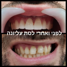 אביב סמייל  מנוהל