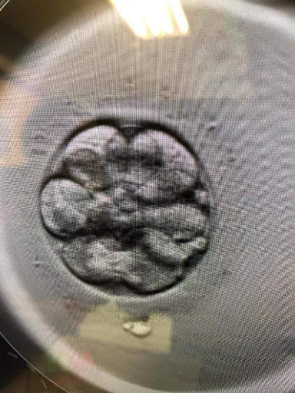 המרכז הארצי לפריון המרכז הארצי לפריון