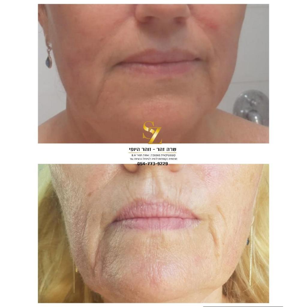 זוהר היופי שרה זהר זוהר היופי שרה זהר