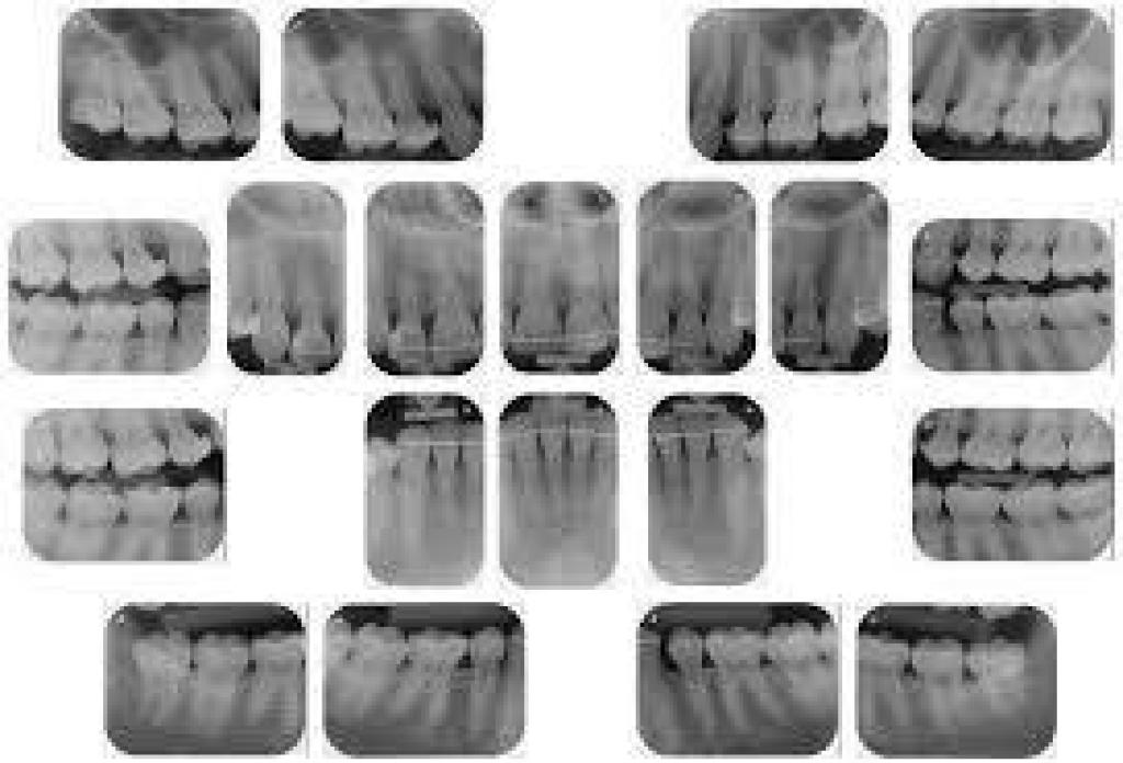 גיל שן גיל שן