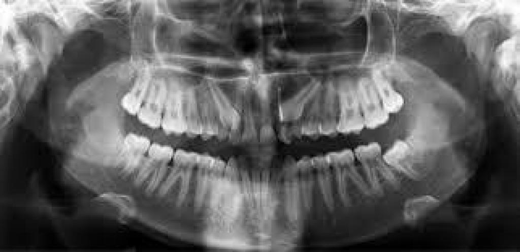 גיל שן גיל שן