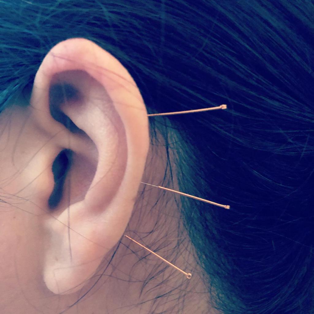 עידו קומפנו עידו קומפנו