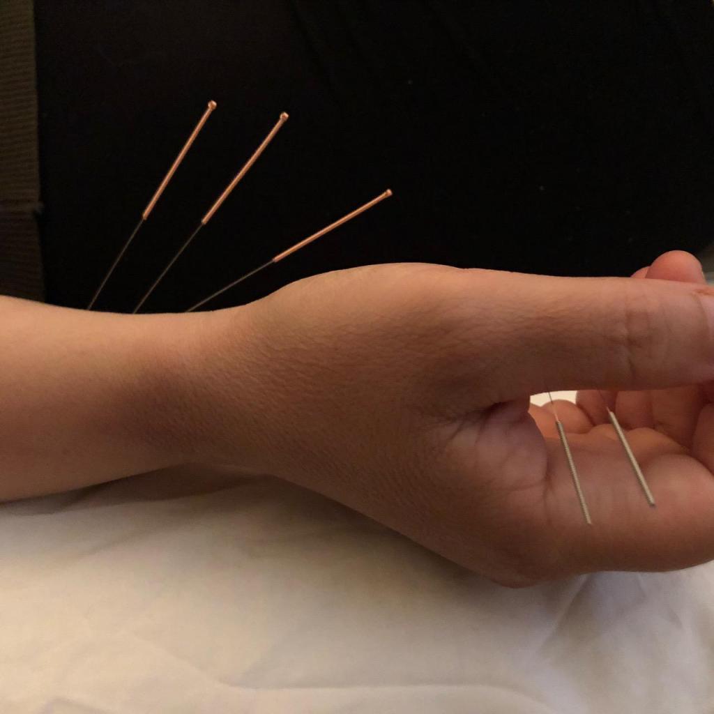 עידו קומפנו עידו קומפנו