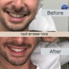 ד"ר אלינה גופמן 