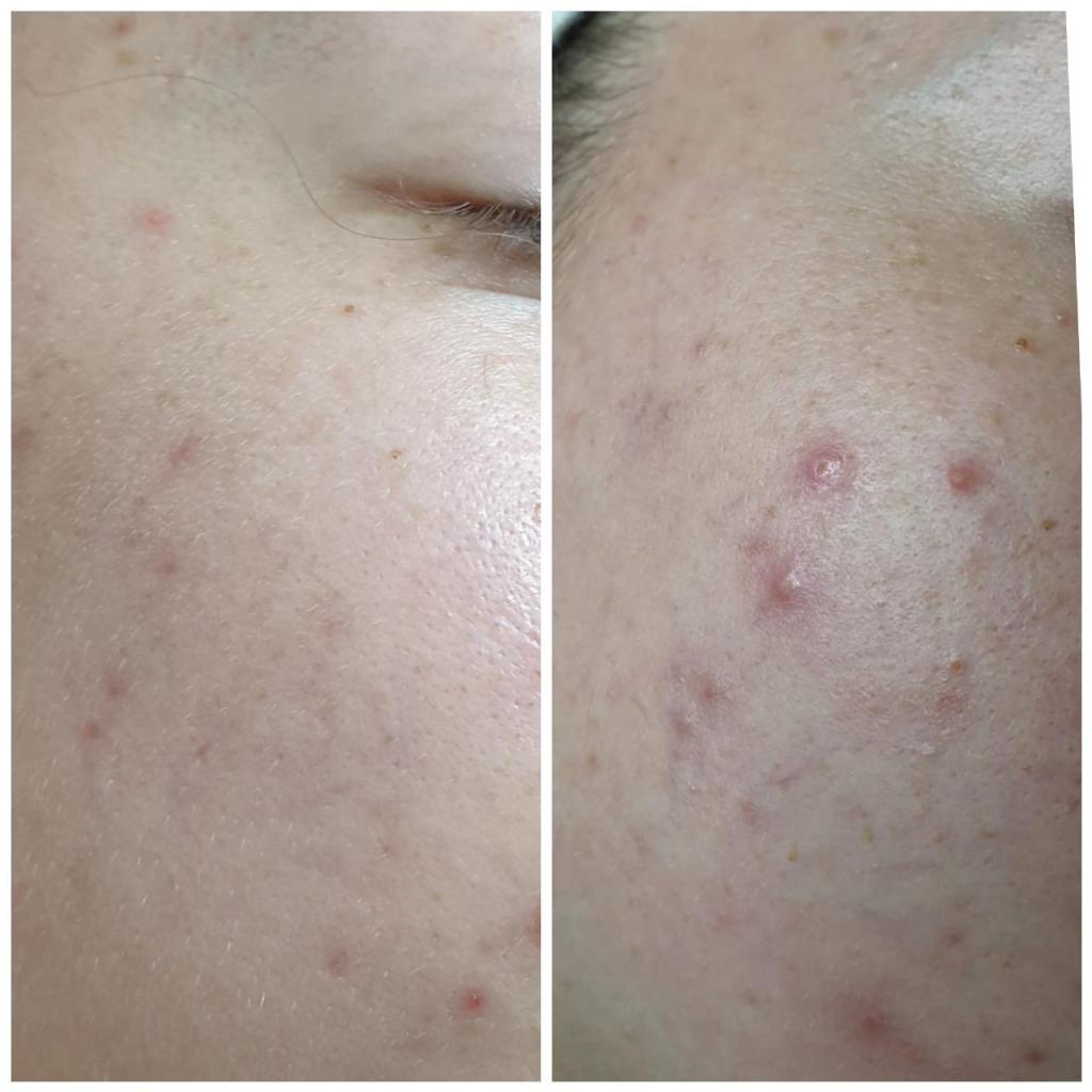 עדי רענן עדי רענן