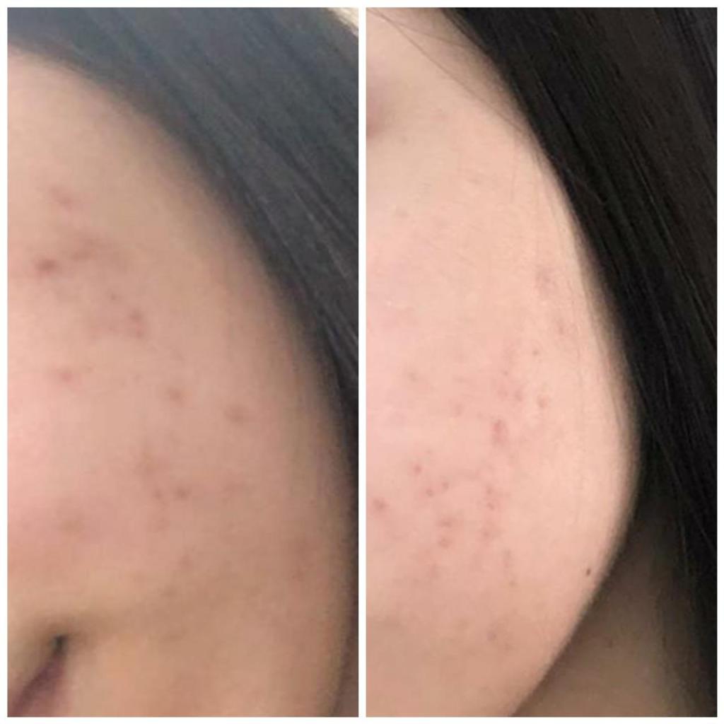 עדי רענן עדי רענן