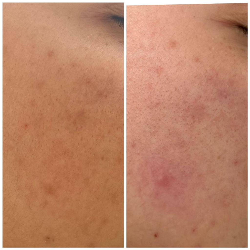 עדי רענן עדי רענן