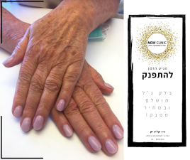 עדנה וחנה