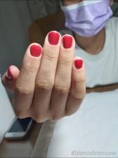 Tal's Gel