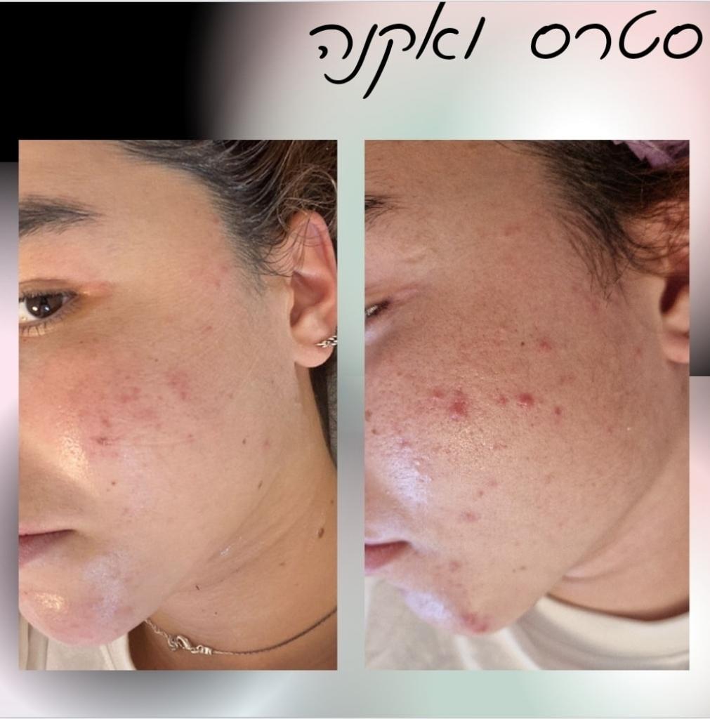 ליזי ציוני ליזי ציוני