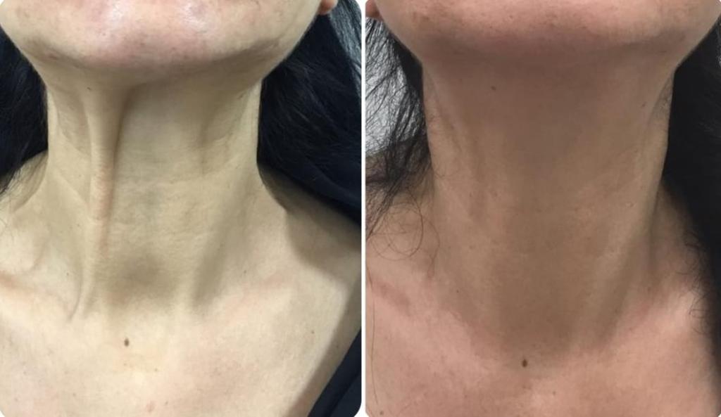 נטורלוק נטורלוק