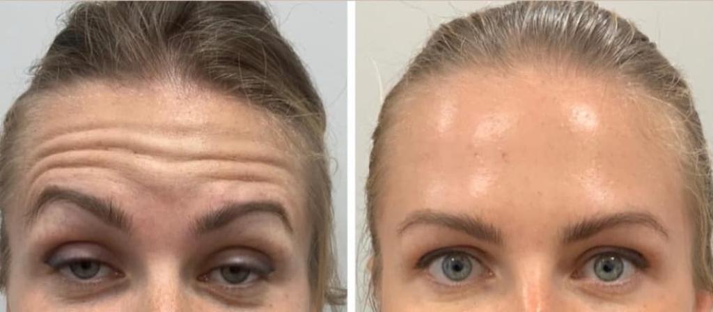 נטורלוק נטורלוק