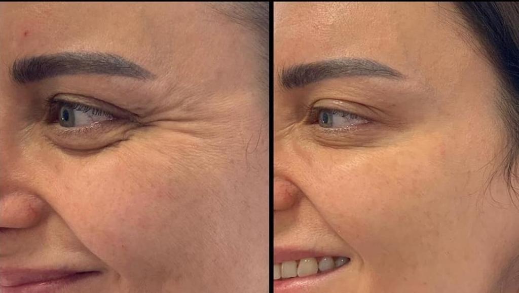 נטורלוק נטורלוק