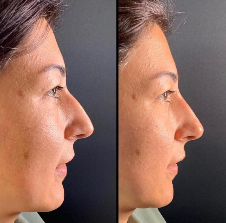 נטורלוק נטורלוק