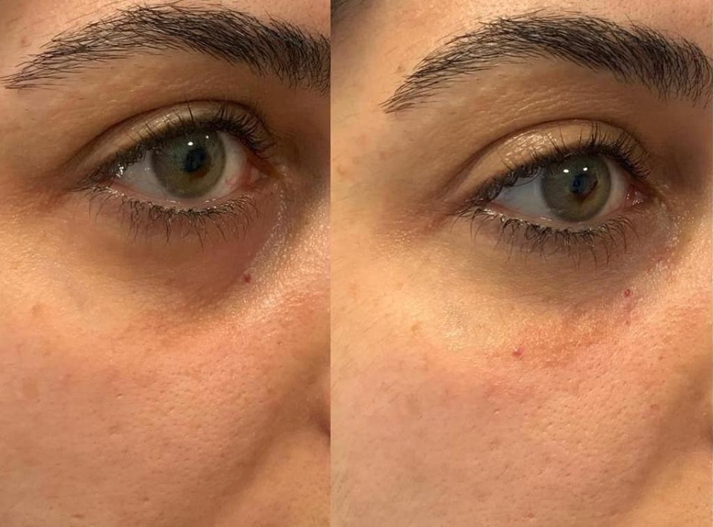 נטורלוק נטורלוק