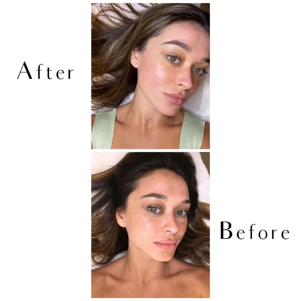 שירלי קוזינץ שירלי קוזינץ