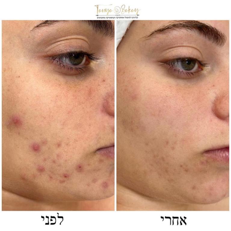 טניה בקאי קוסמטיקאית PME טניה בקאי קוסמטיקאית PME