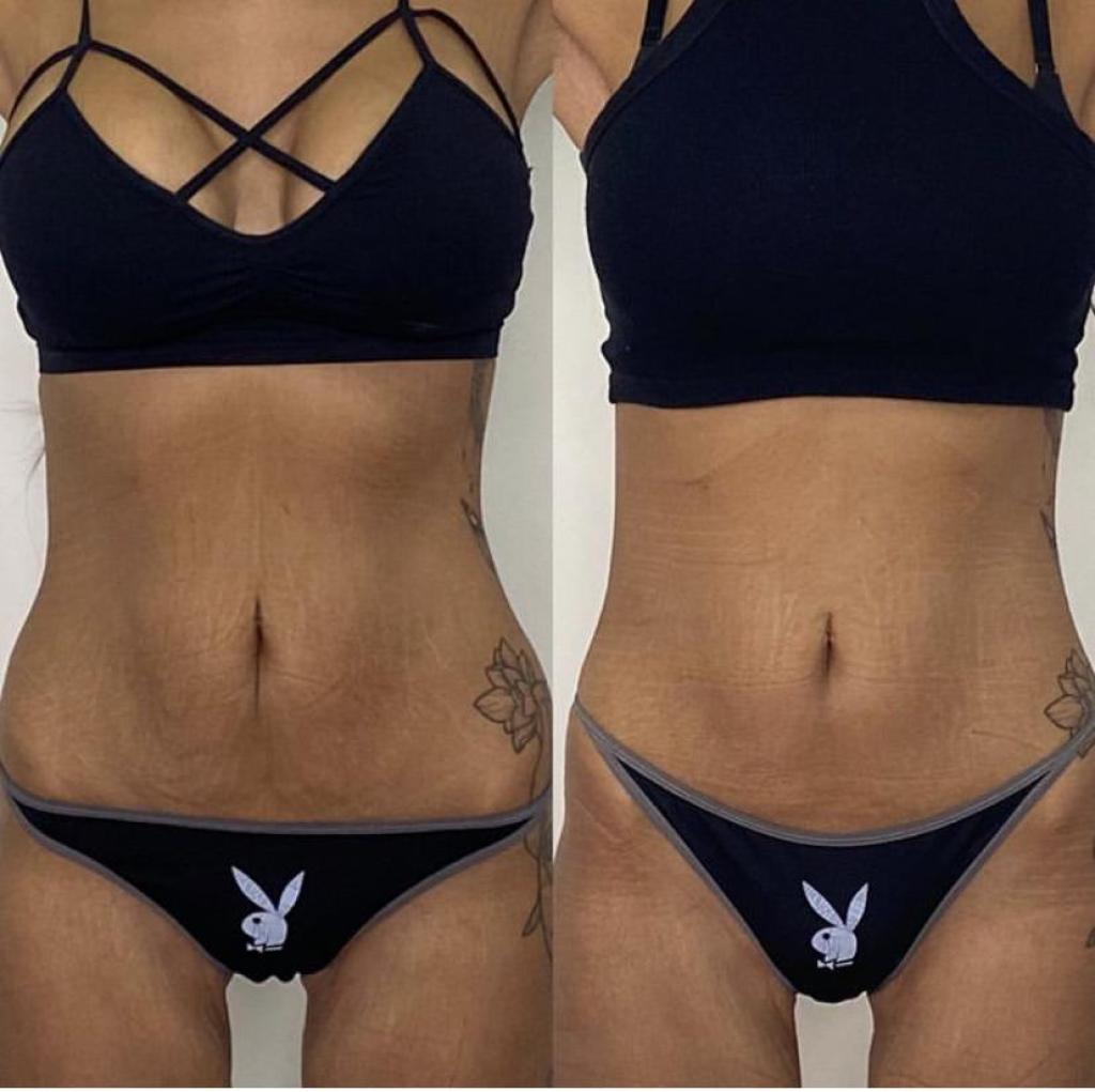 ג'ויה ביוטי ג'ויה ביוטי