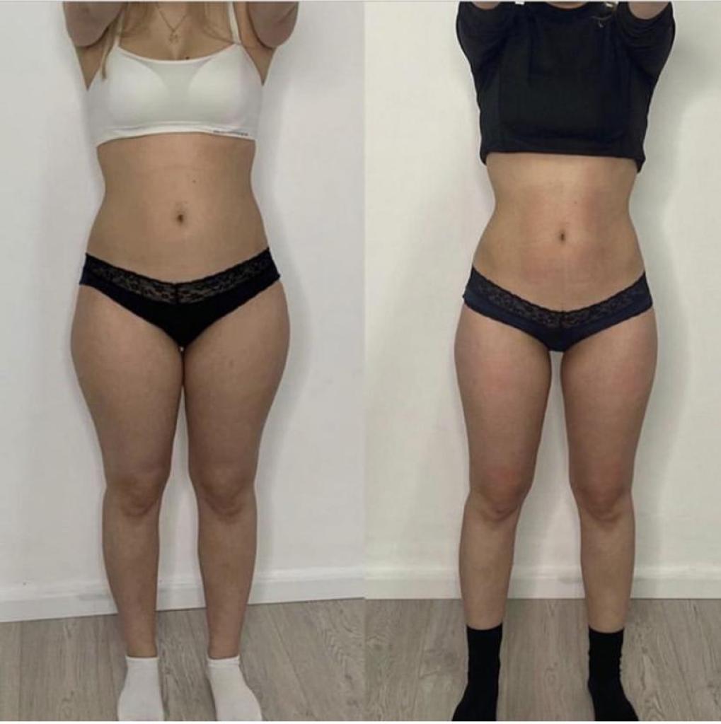 ג'ויה ביוטי ג'ויה ביוטי