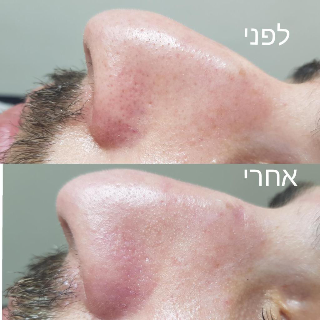 Piastro cosmetics Piastro cosmetics