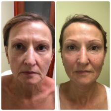 Cosmetologelinadukov