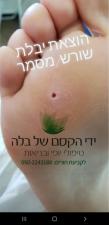 ידי הקסם של בלה