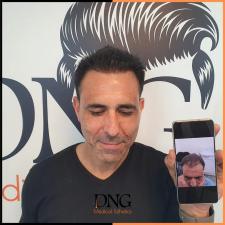 Dng medical