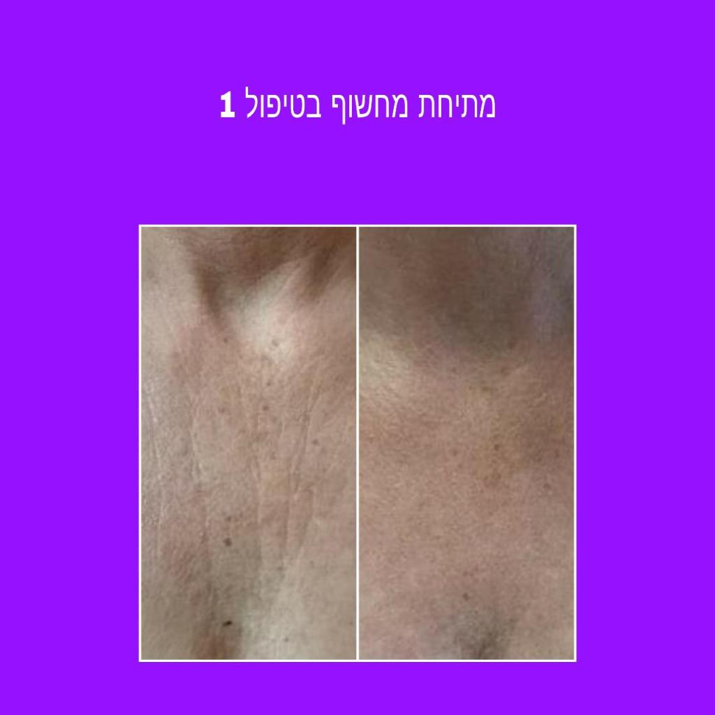 ליב ביוטי אקדמי ליב ביוטי אקדמי