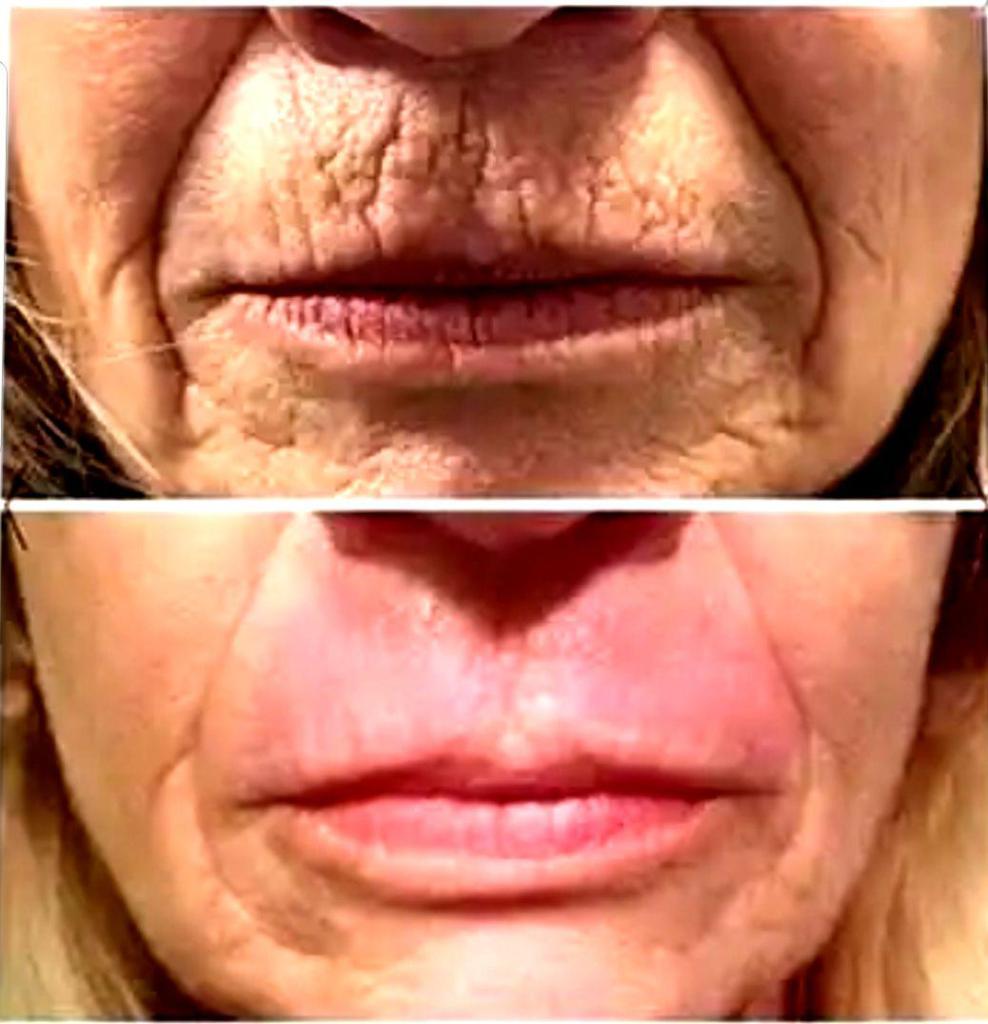 ליב ביוטי אקדמי ליב ביוטי אקדמי