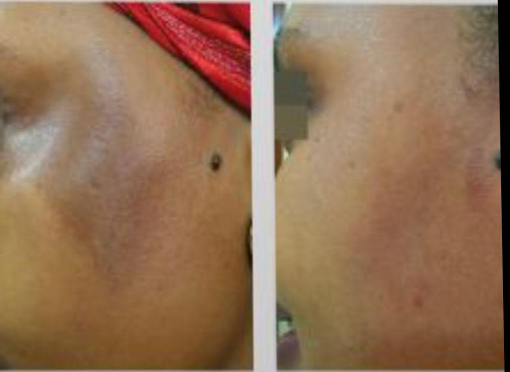 ליב ביוטי אקדמי ליב ביוטי אקדמי