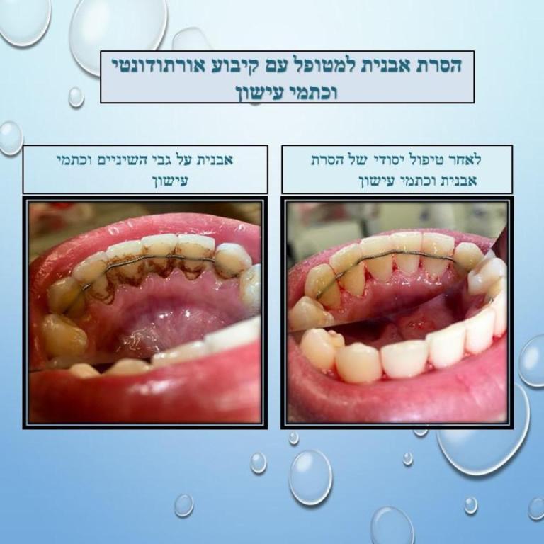 אוסנת לב אוסנת לב