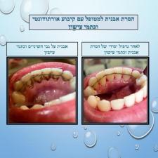 אוסנת לב