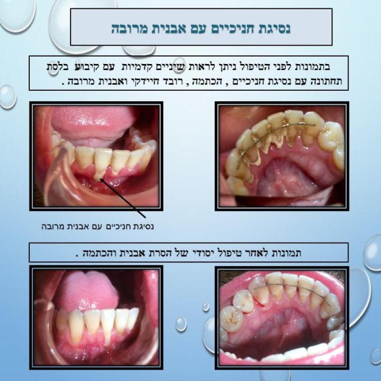 אוסנת לב אוסנת לב