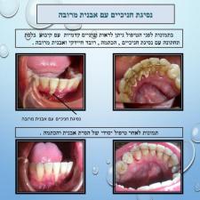 אוסנת לב