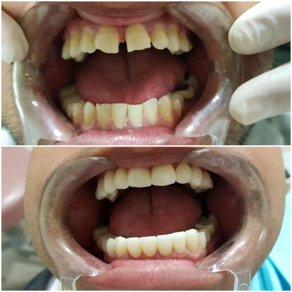 ד"ר מאור ניאזוב ד"ר מאור ניאזוב