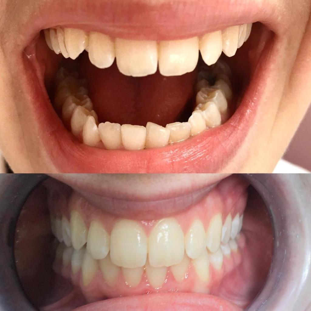 ד"ר מאור ניאזוב ד"ר מאור ניאזוב