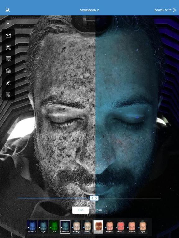 המרכז לפתרונות עור MB המרכז לפתרונות עור MB