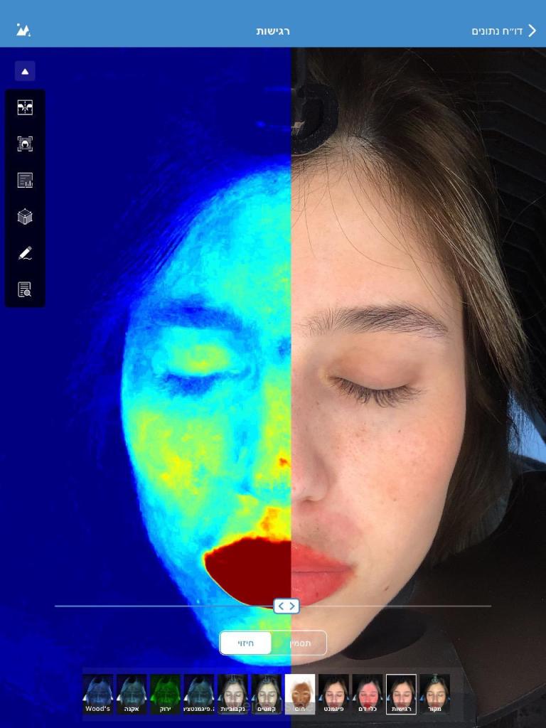 המרכז לפתרונות עור MB המרכז לפתרונות עור MB