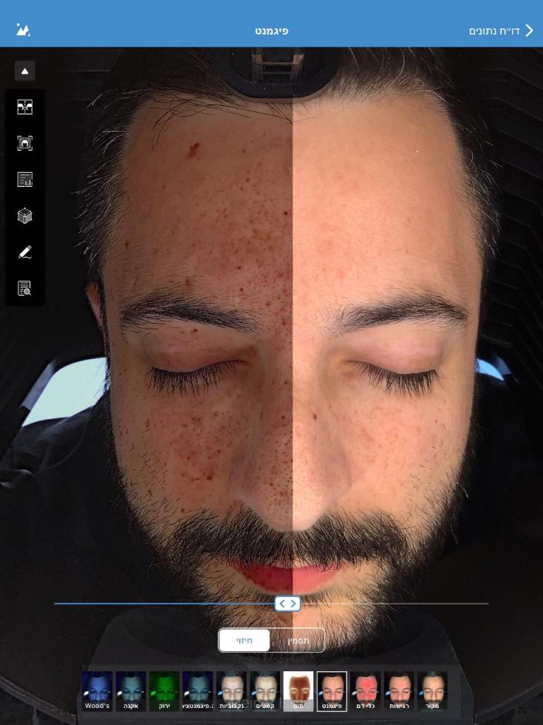 המרכז לפתרונות עור MB המרכז לפתרונות עור MB